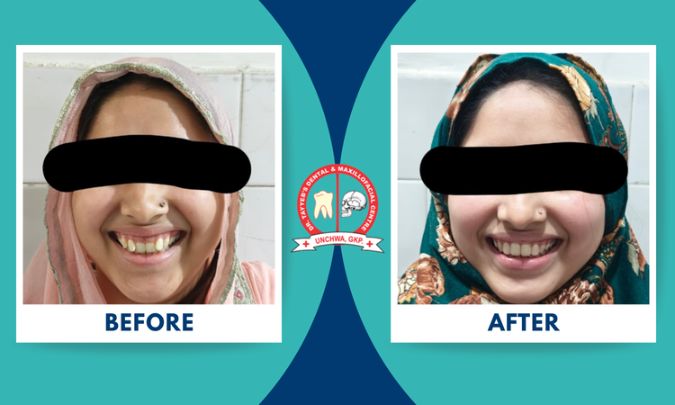 braces treatment at dr tayyeb's
